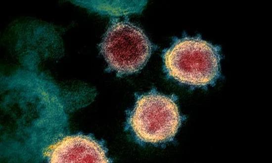 这一初步试验将确认研究中使用新冠病毒的“精确剂量”。